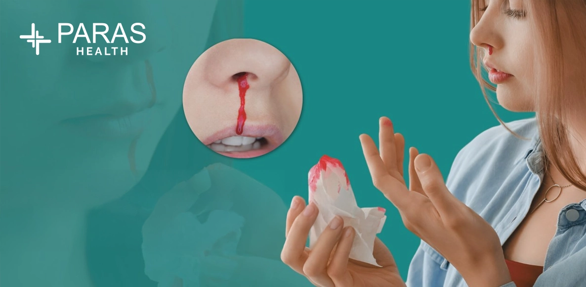 Summer Nosebleeds: Causes, Effects, and Prevention